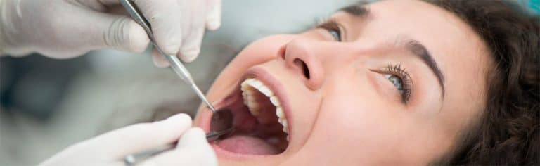 Full Dental Examination