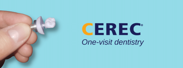 Cerec Crown In A Day Banner