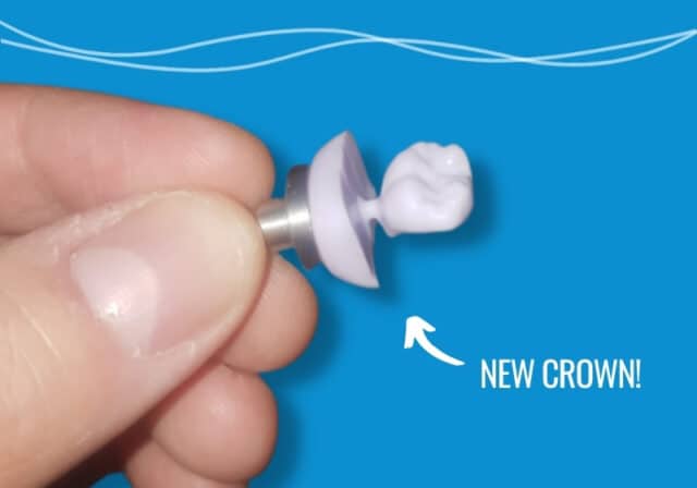 Pathway Dental Cerec Crown In A Day - New Crown